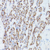 Cell Biology Antibodies 2 Anti-RPS18 Antibody CAB11687