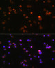 Signal Transduction Antibodies 1 Anti-P2RX5 Antibody CAB11710
