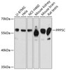 Epigenetics and Nuclear Signaling Antibodies 1 Anti-PPP5C Antibody CAB11712
