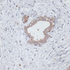Cell Death Antibodies 1 Anti-TGFBR2 Antibody CAB11765