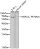 Cell Biology Antibodies 2 Anti-NOXA2 / P67phox Antibody CAB1178