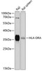 Immunology Antibodies 1 Anti-HLA-DRA Antibody CAB11787