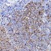 Cell Death Antibodies 1 Anti-TGFBR2 Antibody CAB11788