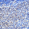 Cell Biology Antibodies 2 Anti-Snail Antibody CAB11794