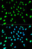 Cell Biology Antibodies 2 Anti-TARDBP Antibody CAB1183