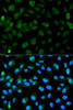 KO Validated Antibodies 1 Anti-PML Antibody CAB1184KO Validated