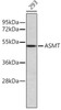 Metabolism Antibodies 1 Anti-ASMT Antibody CAB11840