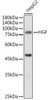 Cell Biology Antibodies 2 Anti-HGF Antibody CAB1193