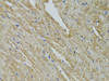 Cell Death Antibodies 1 Anti-FHIT Antibody CAB1196
