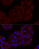 Immunology Antibodies 1 Anti-KLRK1 Antibody CAB11964
