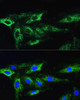 Autophagy Antibodies Anti-ATG16L1 Antibody CAB11969