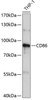 Immunology Antibodies 1 Anti-CD86 Antibody CAB1199