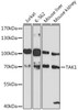 Cell Death Antibodies 1 Anti-TAK1 Antibody CAB12022