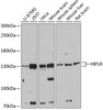 Cell Biology Antibodies 2 Anti-HIP1R Antibody CAB12026