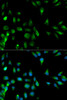 Cell Cycle Antibodies 1 Anti-RASSF1 Antibody CAB1203