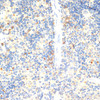 Epigenetics and Nuclear Signaling Antibodies 1 Anti-FOXP3 Antibody CAB12051