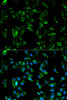 Cell Biology Antibodies 2 Anti-TPM3 Antibody CAB1206