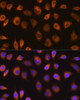 Signal Transduction Antibodies 1 Anti-SEL1L Antibody CAB12073