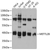 Epigenetics and Nuclear Signaling Antibodies 1 Anti-METTL2B Antibody CAB12082