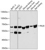 Metabolism Antibodies 1 Anti-PKLR Antibody CAB12084