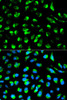 Metabolism Antibodies 1 Anti-ECI1 Antibody CAB1211