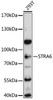 Signal Transduction Antibodies 1 Anti-STRA6 Antibody CAB12126
