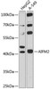 Cell Death Antibodies 1 Anti-AIFM2 Antibody CAB12128