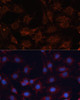 Signal Transduction Antibodies 1 Anti-SLC25A24 Antibody CAB12138