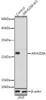 KO Validated Antibodies 1 Anti-ARHGDIA Antibody CAB1214KO Validated