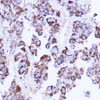 KO Validated Antibodies 1 Anti-SHMT2 Antibody CAB1215KO Validated