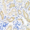 Cell Biology Antibodies 2 Anti-SRPX Antibody CAB1217