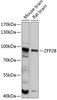 Epigenetics and Nuclear Signaling Antibodies 1 Anti-ZFP28 Antibody CAB12231