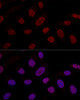 Cell Biology Antibodies 2 Anti-Snail Antibody CAB12301