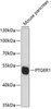 Cell Biology Antibodies 2 Anti-PTGER1 Antibody CAB12310