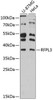 Immunology Antibodies 1 Anti-RFPL3 Antibody CAB12361