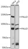 Cell Biology Antibodies 2 Anti-PALLD Antibody CAB12362