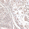 Cell Death Antibodies 1 Anti-MEF2C Antibody CAB12385