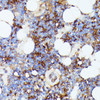 Cell Biology Antibodies 3 Anti-Iba1 Antibody CAB12391