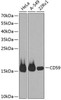 Cell Biology Antibodies 3 Anti-CD59 Antibody CAB12412
