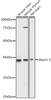 Epigenetics and Nuclear Signaling Antibodies 1 Anti-Ataxin 3 Antibody CAB1243