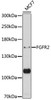 Cell Death Antibodies 1 Anti-FGFR2 Antibody CAB12436