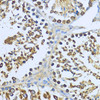 Immunology Antibodies 1 Anti-Hsp90 alpha Antibody CAB12448