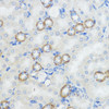 Cell Death Antibodies 1 Anti-NOD1 Antibody CAB1246