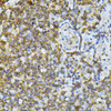 Cell Biology Antibodies 16 Anti-MT-ND5 Antibody CAB12465