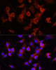 Immunology Antibodies 1 Anti-SERPINA1 Antibody CAB12481