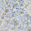 Immunology Antibodies 1 Anti-SERPINA1 Antibody CAB12481