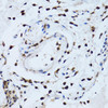 Cell Biology Antibodies 3 Anti-PSMD13 Antibody CAB12485