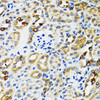 Cell Biology Antibodies 3 Anti-RPN1 Antibody CAB12497