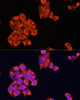 Metabolism Antibodies 1 Anti-Cox2 Antibody CAB1253