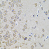 Cell Biology Antibodies 3 Anti-WISP2 Antibody CAB12541